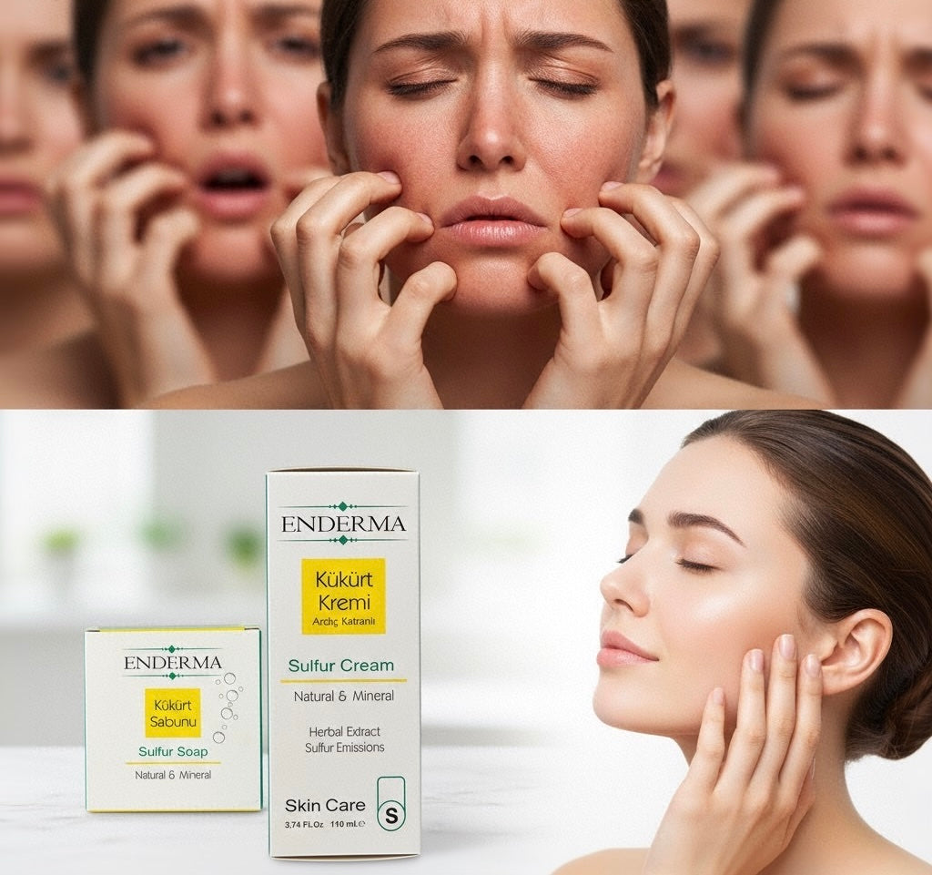 Enderma- Kükürt Kremi +Kükürt Sabunu 1+1 Kampanya